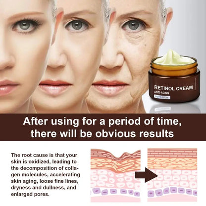 Crema de suero de retinol 30 g para el contorno de ojos: reafirmante, reafirmante, antienvejecimiento, reduce arrugas y líneas de expresión.