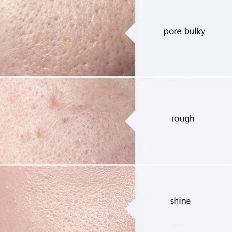 Kit Aqua Peel Premium 3 Soros 400ml Limpeza Facial Profissional Hidratação Esfoliação Tratamento Spa Casa