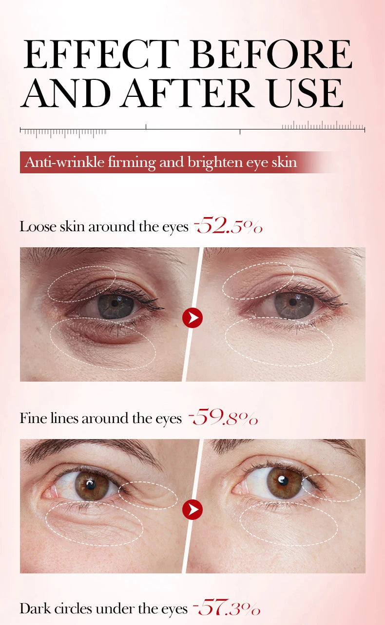 Conjunto BIOAQUA Caracol Anti-Idade - Sérum Facial Creme Olhos Hidratante Iluminador