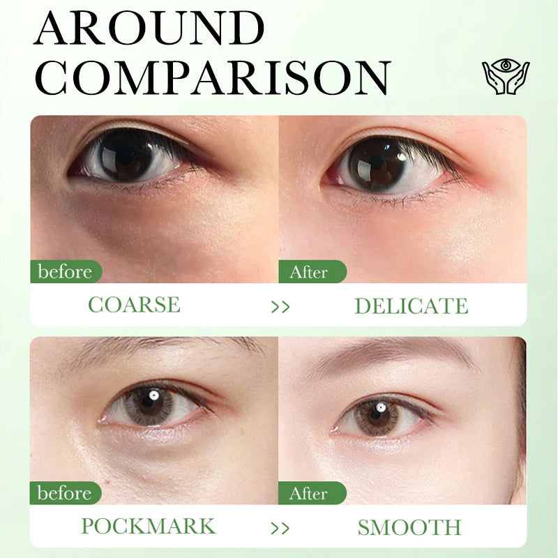 Crema para ojos con centella asiática: hidratante, reafirmante, aclara ojeras, suaviza líneas de expresión y nutre (20 g)