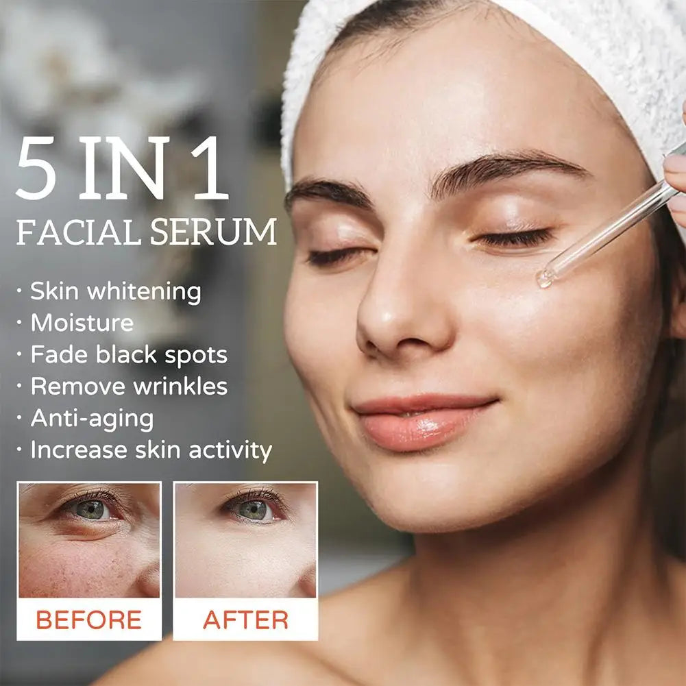 Sérum facial 5 en 1 con 30 % de vitamina C: antiarrugas, hidratante, iluminador, niacinamida y ácido hialurónico (30 ml)