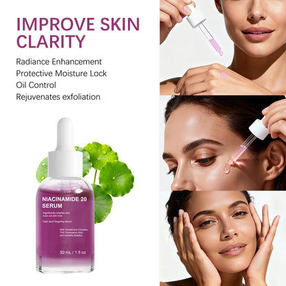 Suero iluminador de niacinamida: controla la oleosidad, reafirma, aclara las manchas oscuras, hidrata y repara. Asiaticósido.