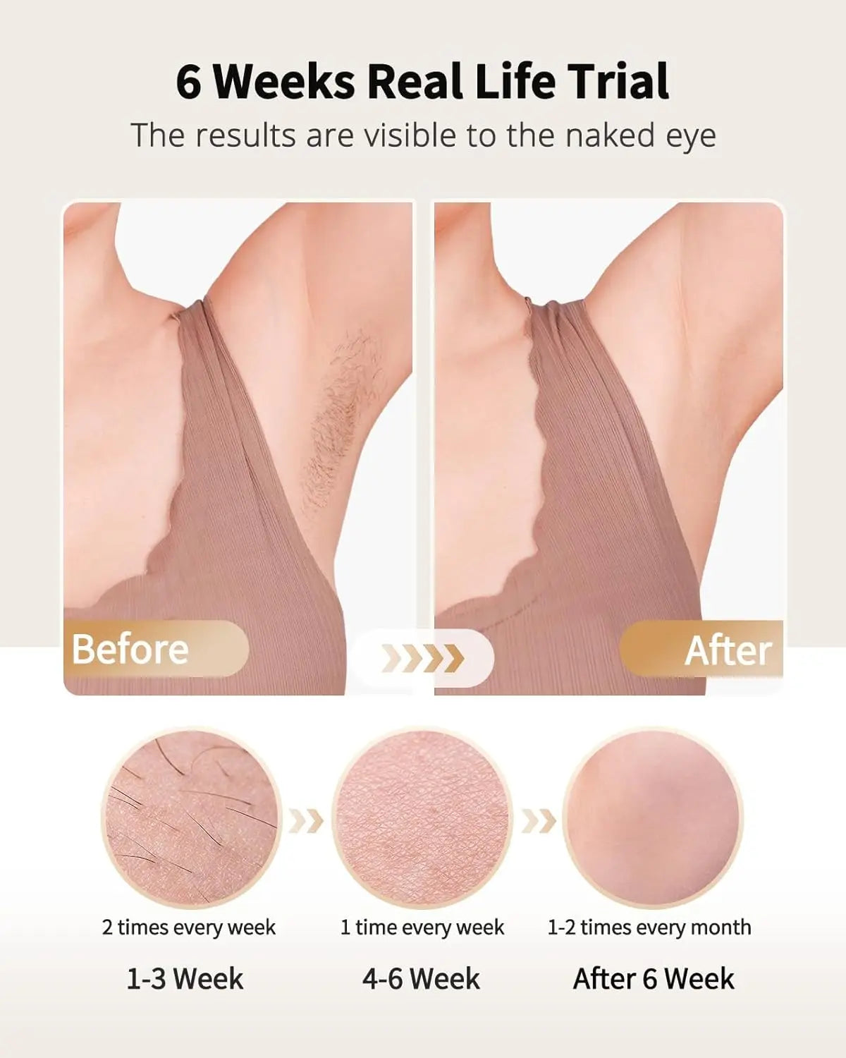 Depilador IPL Laser com Arrefecimento