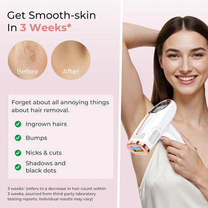 Depilador IPL Flashes