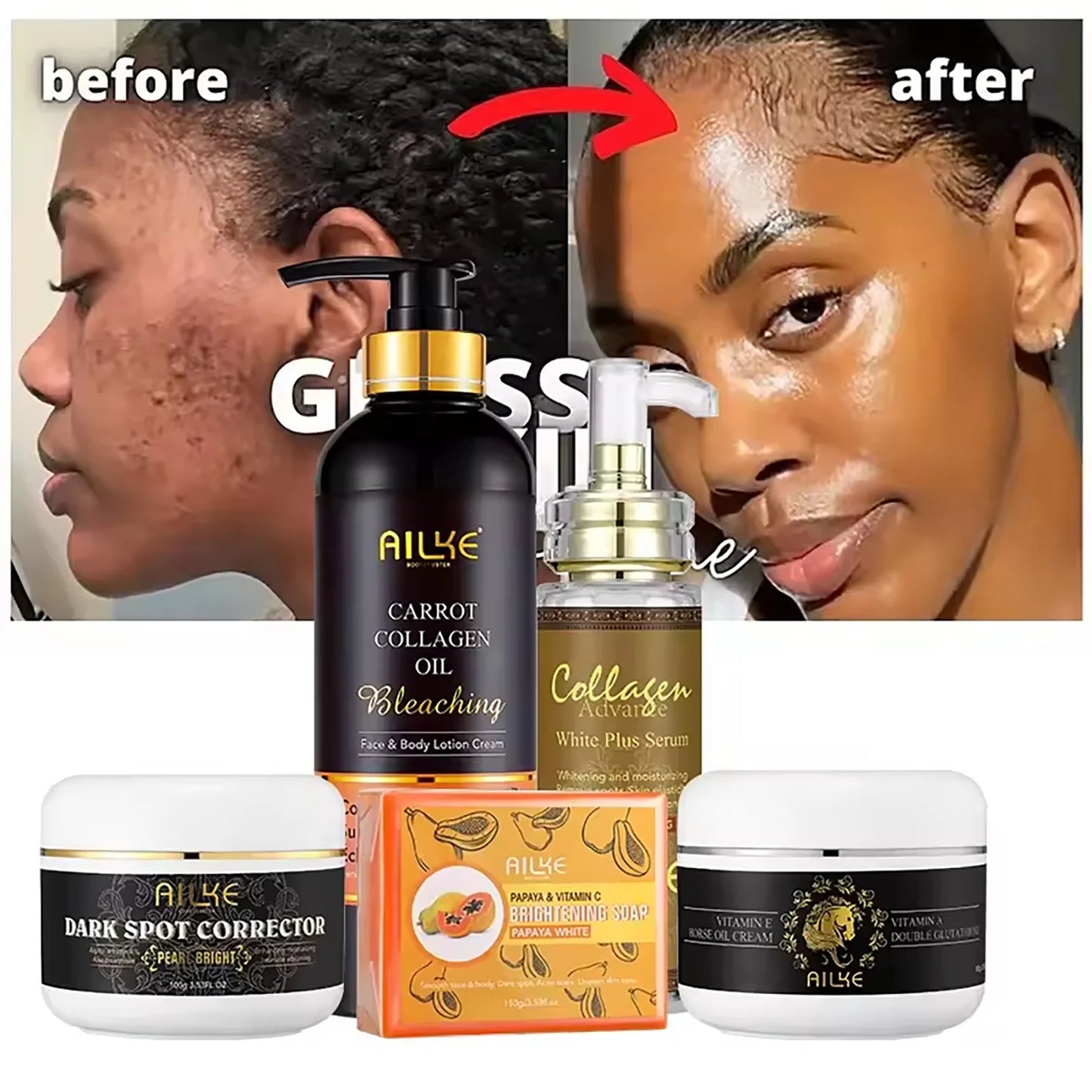 AILKE Premium 5-in-1 Collagen Kit – Professional Anti-Aging Treatment Hydrates, Brightens, Rejuvenates