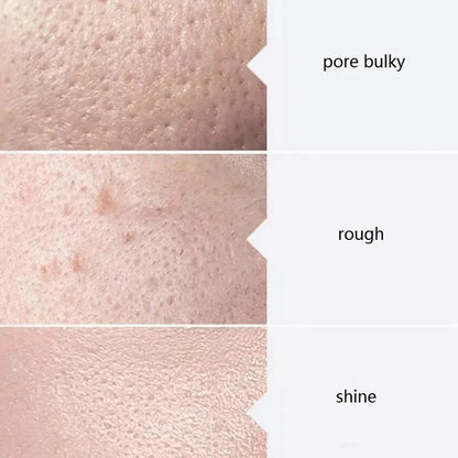 Kit Aqua Peel Premium 3 Soros 400ml Limpeza Facial Profissional Hidratação Esfoliação Tratamento Spa Casa