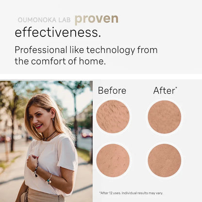 Depilador IPL Flashes