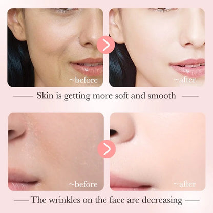 Suero de niacinamida BIOAQUA 30 ml: reduce las manchas oscuras, ilumina, hidrata y tonifica la piel.