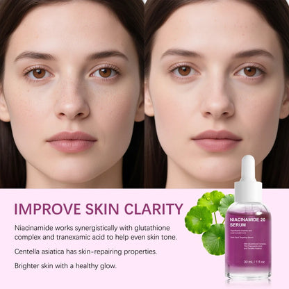 Suero iluminador de niacinamida: controla la oleosidad, reafirma, aclara las manchas oscuras, hidrata y repara. Asiaticósido.