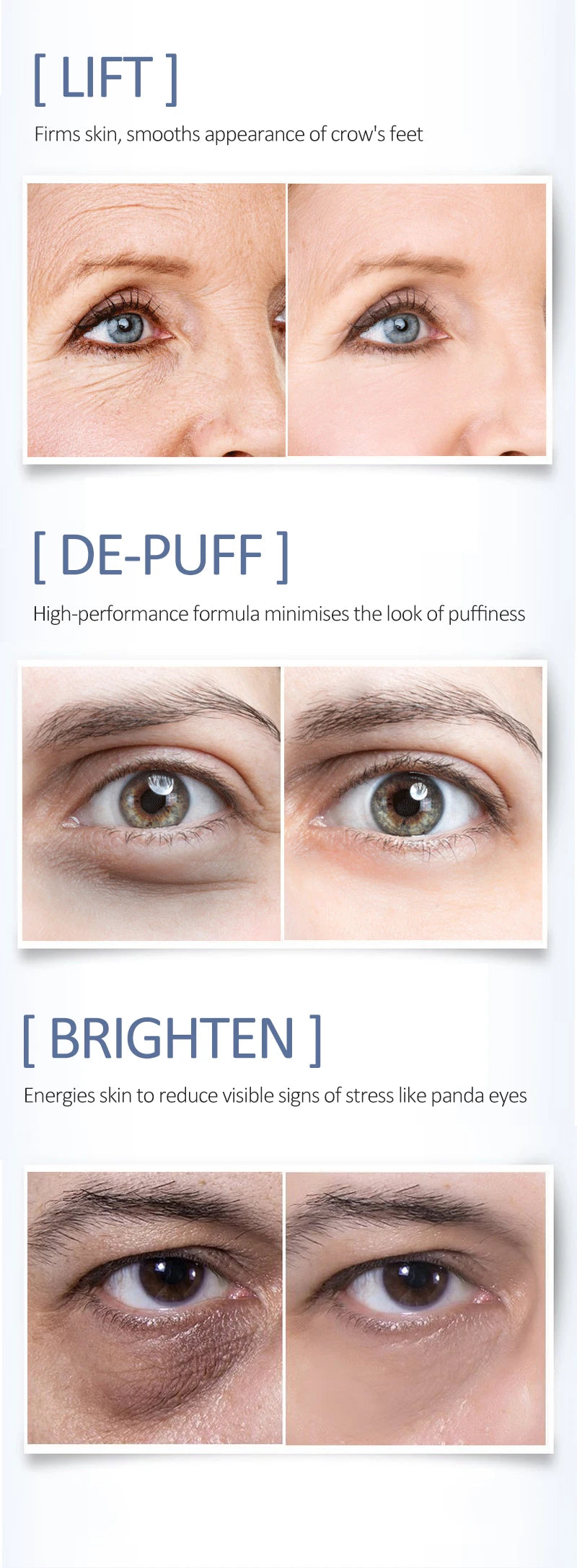 Creme Olhos OCHEAL Hidratante – Linhas Finas Olheiras Sérum Bolsas Inchaço Anti-Idade Firmeza