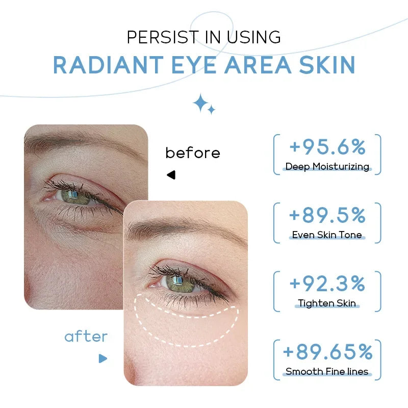 Crema de ojos LAIKOU Milk Eye Cream 20 g: ojeras, bolsas, reafirma, reduce la hinchazón, hidrata el contorno de ojos.